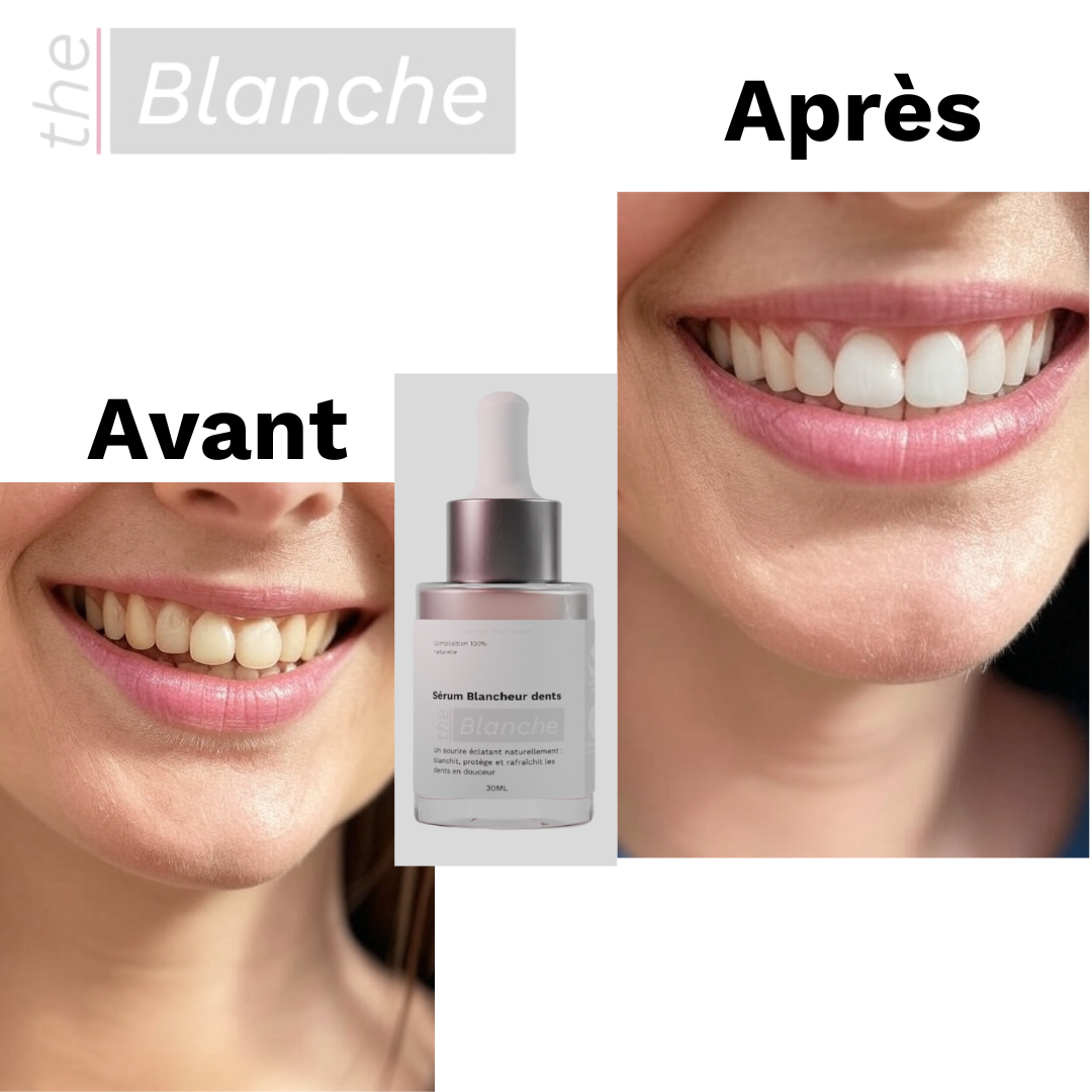 Sérum Blanchissant Dentaire - The Blanche Algérie | Sourire Éclatant & Dents Blanches Naturellement